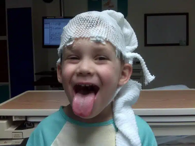 Joyful Colten Polyniak smiling during his first EEG session, displaying a beacon of hope amidst a challenging journey post a grand mal seizure.