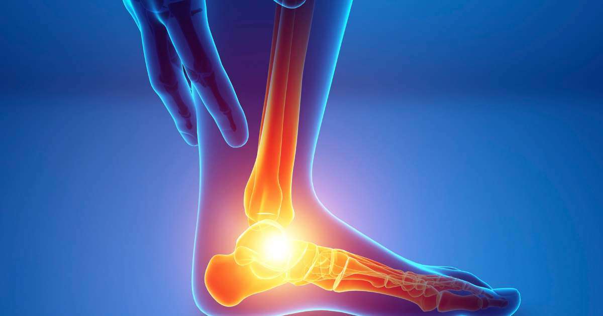 Interactive chart depicting various types of foot pain, including plantar fasciitis, Achilles tendinitis, bunions, and hammertoe, with highlighted areas and descriptions for each condition.