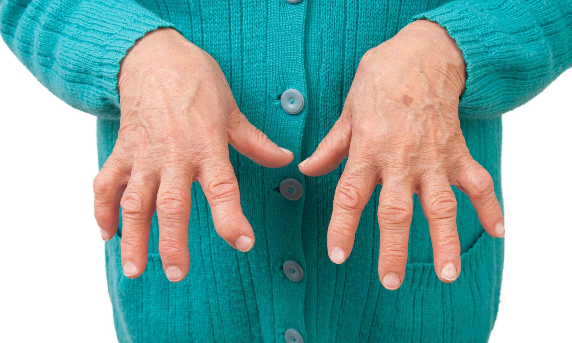 A close-up image of an elderly person's hands, fingers curved and gnarled from arthritis, yet exhibiting a sense of relaxation and ease. The hands are positioned as if typing or writing, symbolizing the act of leaving a positive review for the relief provided by CBD