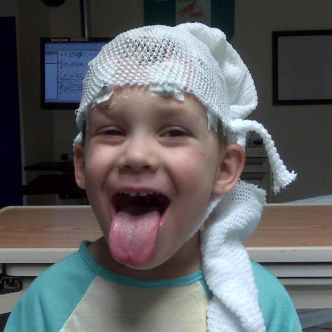Colten Polyniak, in good spirits, making a playful Rock N' Roll face while receiving his first EEG procedure to monitor brain activity.